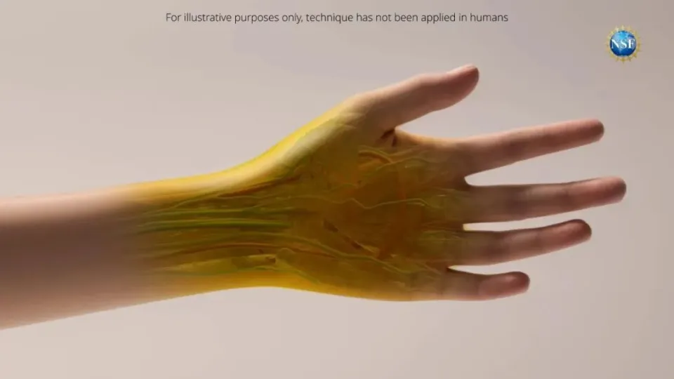 5.png